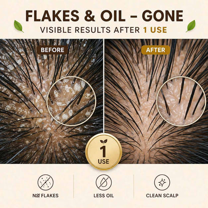 Botalab Menopause reviews- Before and after comparison of flaky skin on a scalp with visible results after one use.